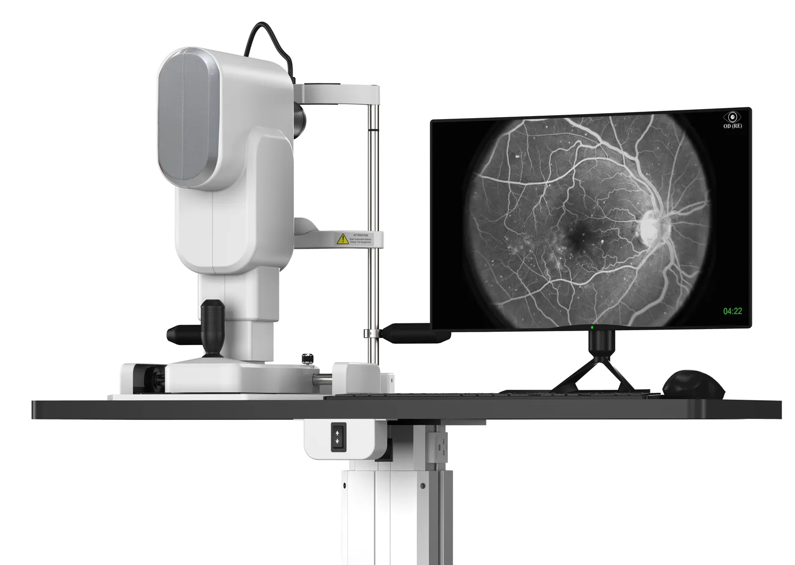 Ophthalmic diagnostic imaging system